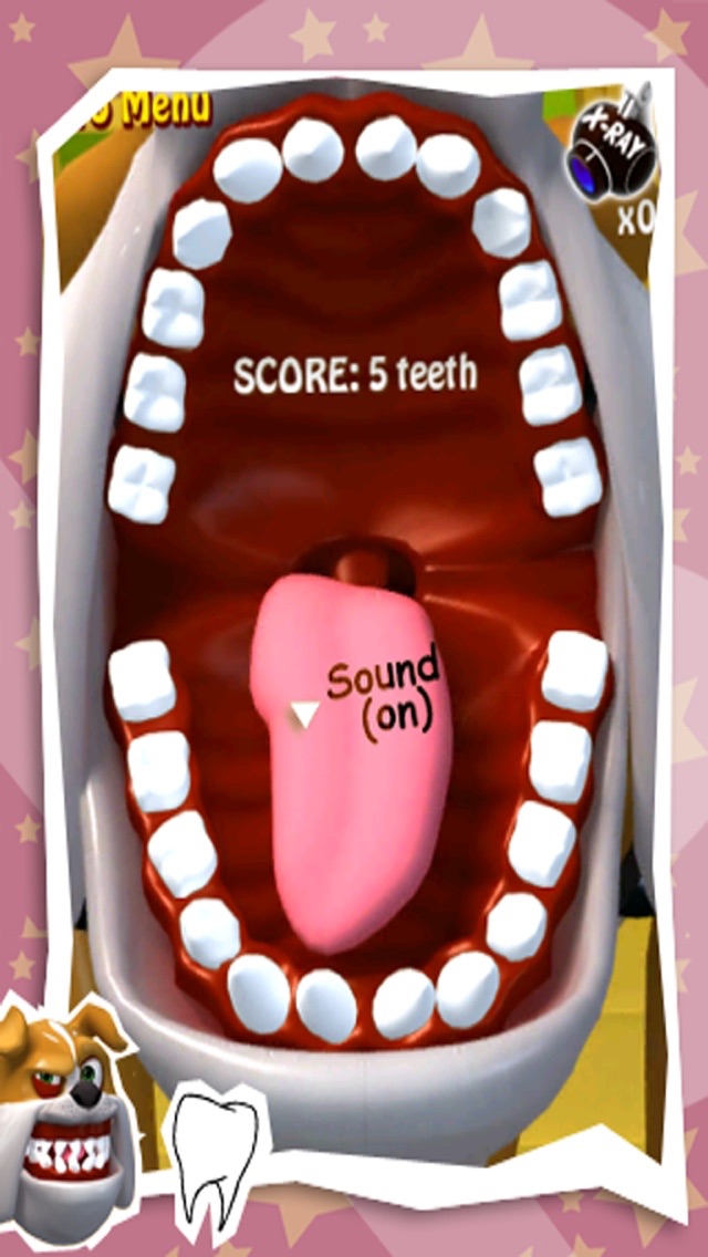 SPARK TOOTH OUT 3.0 IOS GAME GIẢI TRÍ SPARK TOOTH OUT 3.0 IOS