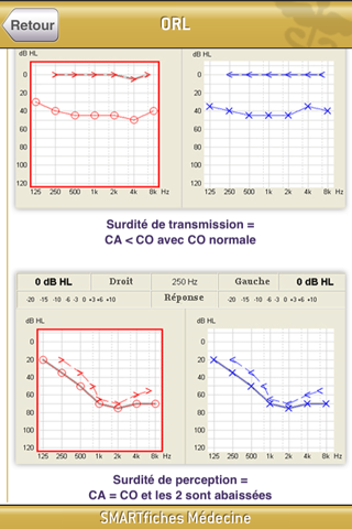 SMARTfiches Oto-Rhino-Laryngologie Free screenshot 4