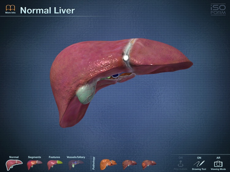 AR Liver Viewer