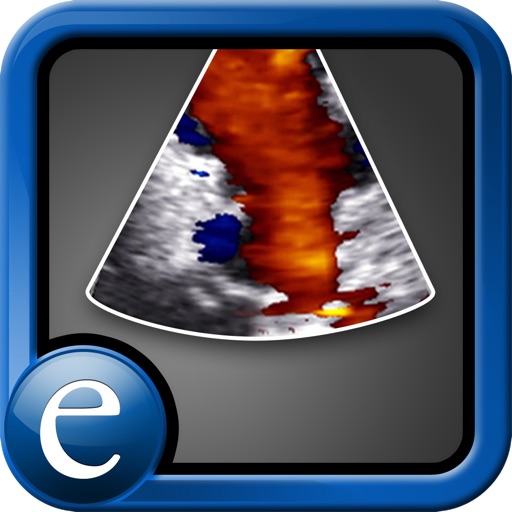 Echocardiography Atlas by Epocrates, edited by Scott D. Solomon, MD icon