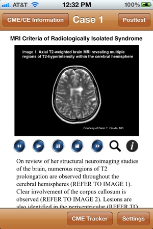 Multiple Sclerosis - MedImage Cases(圖1)-速報App