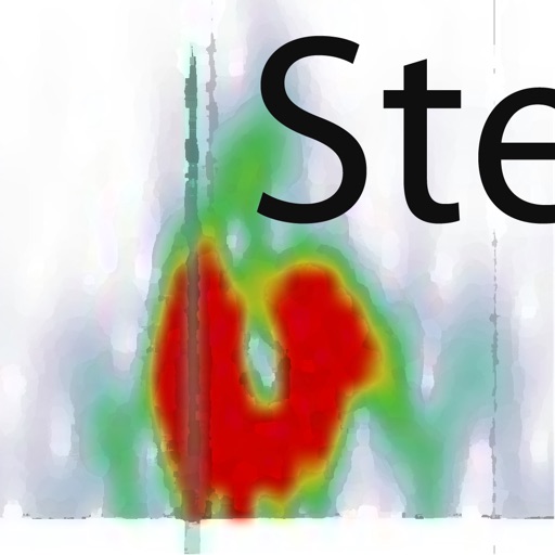 Mobile Stethoscope