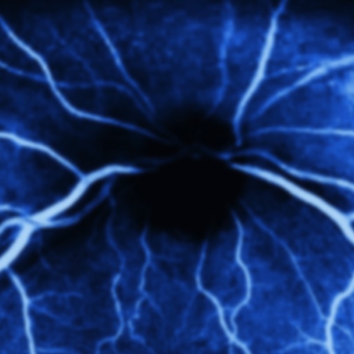 iEye Retina