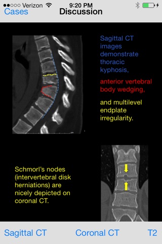 Free Neuroradiology Cases screenshot 3