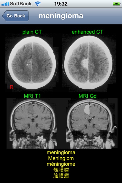 neuroradiology multilingual