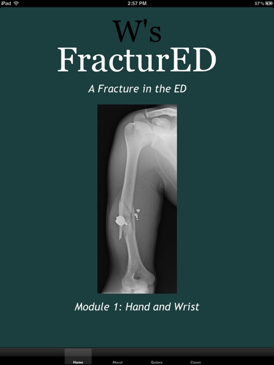 FracturED: A Fracture in the ED; Module 1: Hand and Wrist