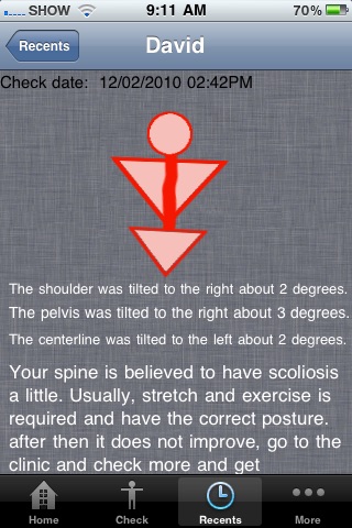 Vertebra(spine) checker (scoliosis) lite screenshot 3
