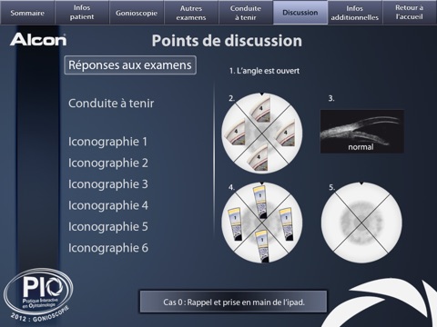 Alcon Gonioscopie screenshot 3
