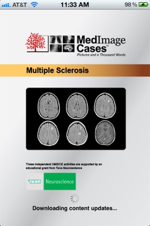 Multiple Sclerosis - MedImage Cases(圖3)-速報App