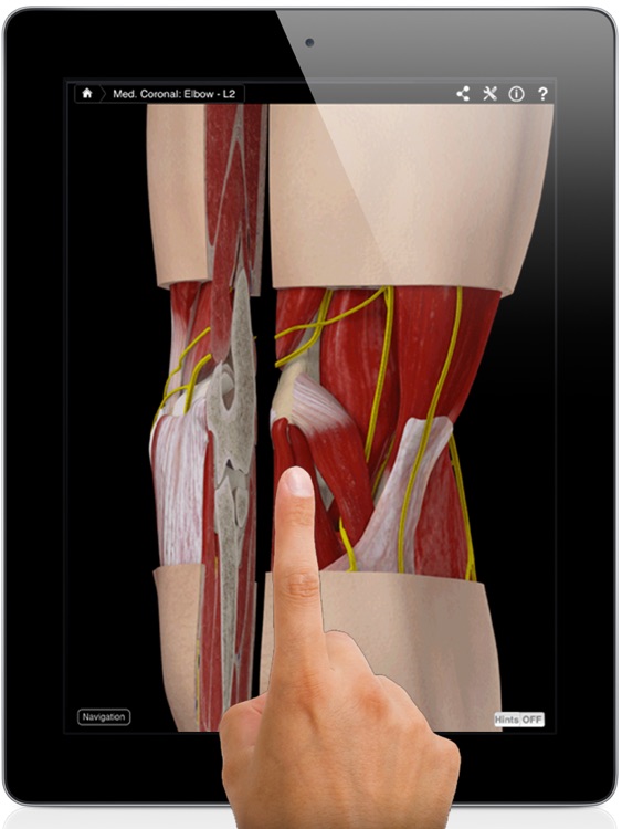 Elbow Pro III for iPad screenshot-0