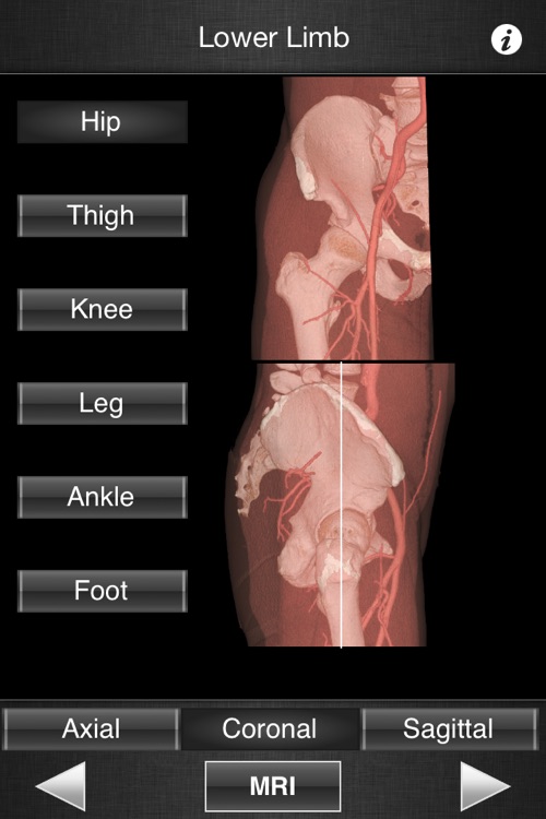 Monster Anatomy HD - Lower Limb