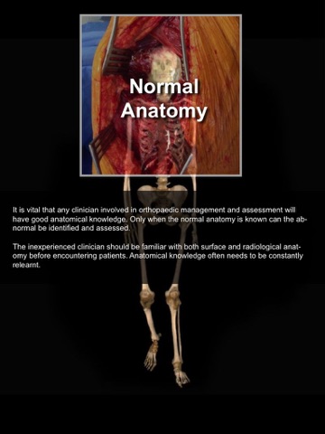 Exploring Essential Orthopaedics screenshot 2