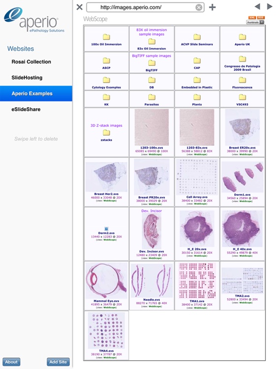 Aperio ePathViewer for iPad