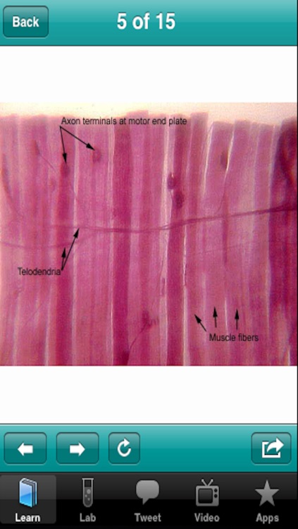 The Musculoskeletal System screenshot-4