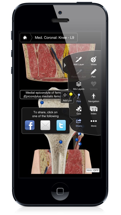 Knee Pro III with Animations - iPhone Edition screenshot-3