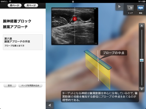 MeAV Anatomie screenshot 2