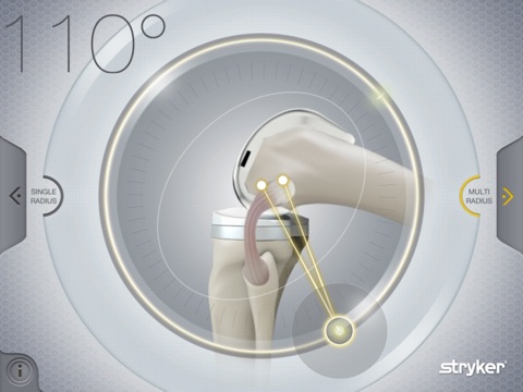 Stryker Get Around Knee screenshot 4