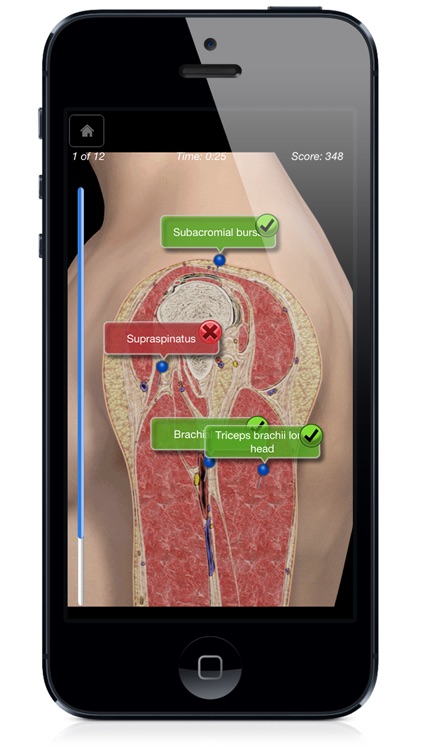 Shoulder Pro III with Animations - iPhone Edition