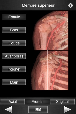 Monster Anatomy - Upper Limb screenshot 3