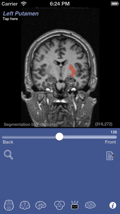 iSurf BrainView