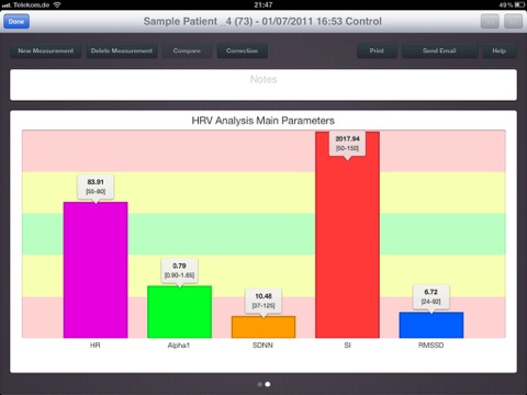 iHRV Light screenshot 2