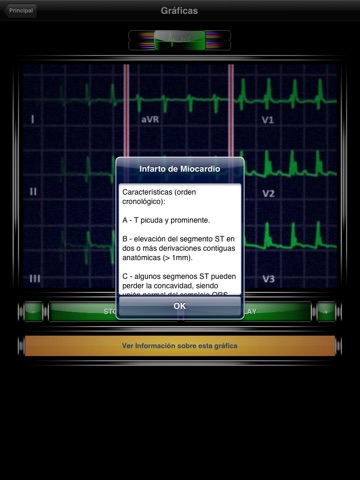 Tipos ECG Electrocardiograma screenshot 3