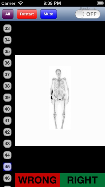 Nuclear Medicine Flashcards