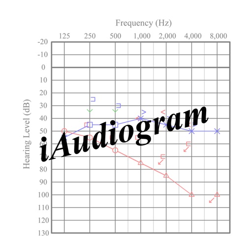 iAudiogram