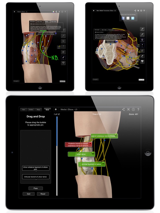 Elbow Pro III for iPad