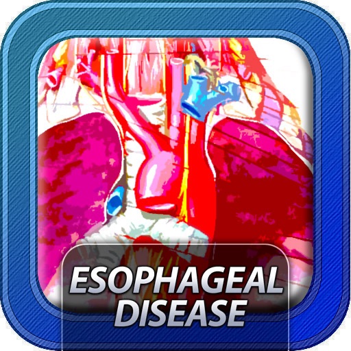 Esophageal Diseases