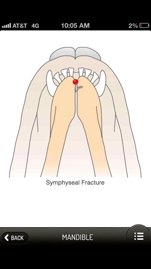 Small Animal Fracture Management(圖4)-速報App