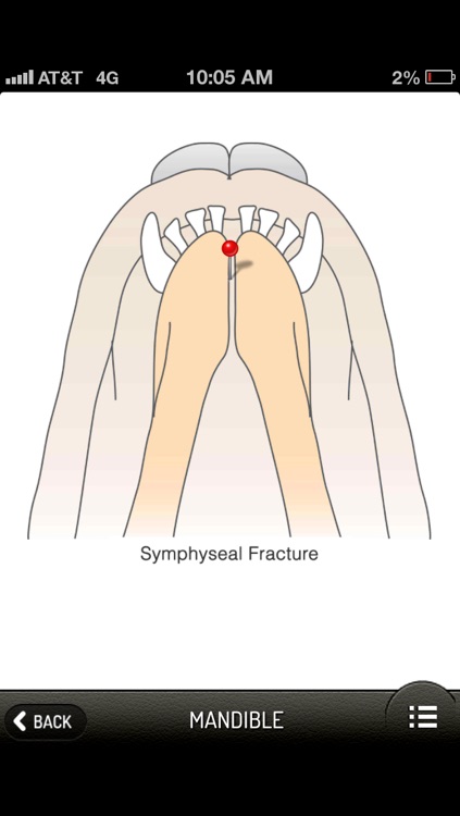 Small Animal Fracture Management screenshot-3