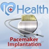 ArchieMD IC Health: Cardiac Pacemaker