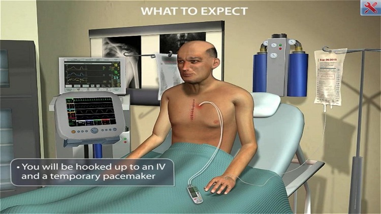 ArchieMD IC Health Coronary Bypass