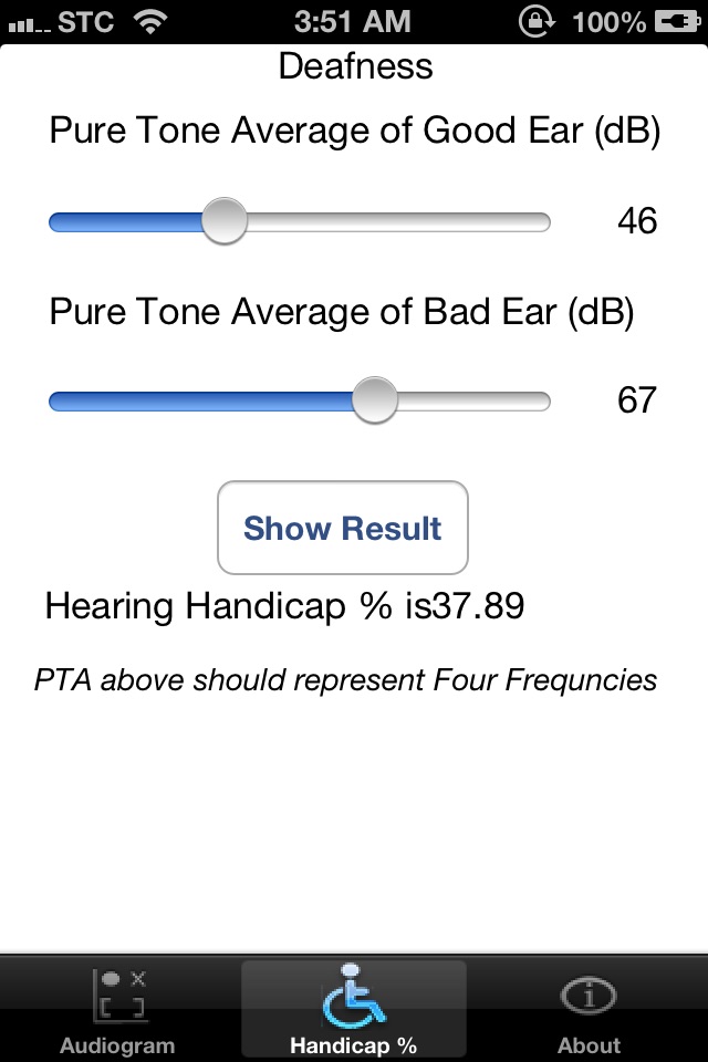 Audiogram Analyzer screenshot 4