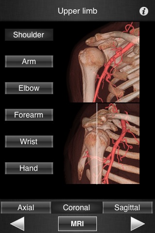 Monster Anatomy - Upper Limb screenshot 3