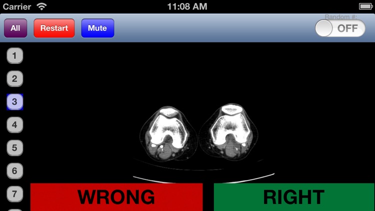 General Radiology 2