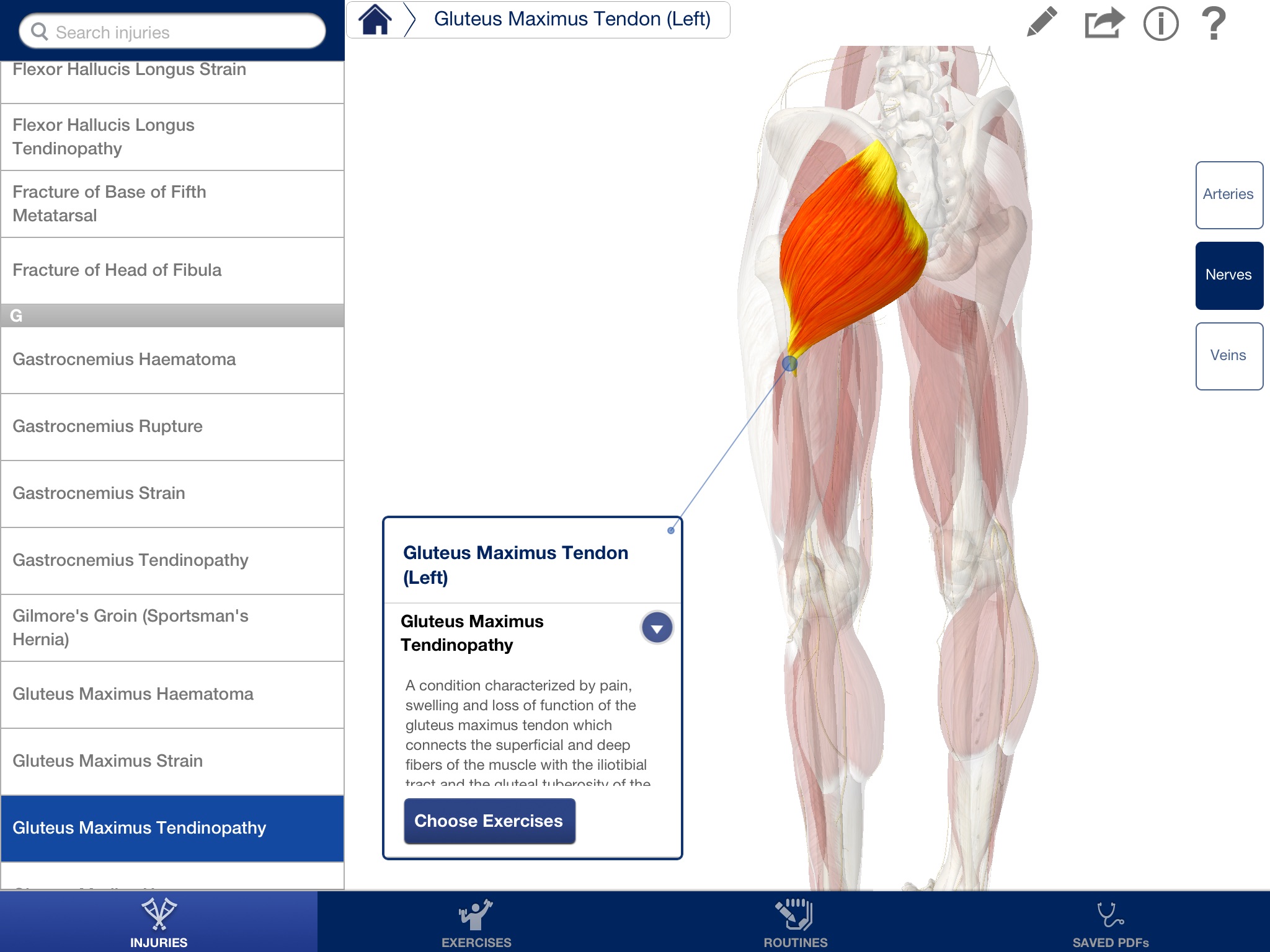 Rehabilitation for Lower Limbs screenshot 2