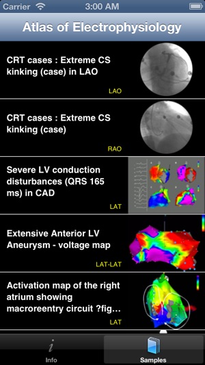 CARDIO3® Atlas of Cardiac Electrophysiology & Arrhythmia(圖1)-速報App