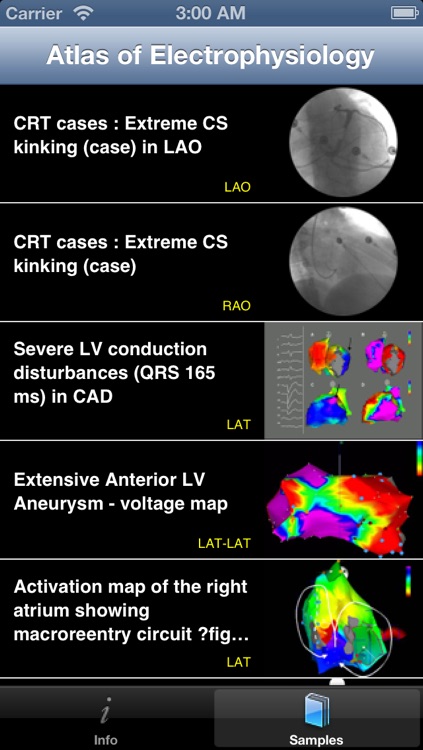 CARDIO3® Atlas of Cardiac Electrophysiology & Arrhythmia