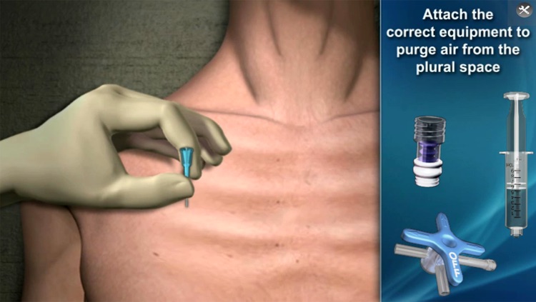 Medrills: NCD for Pneumothorax screenshot-4