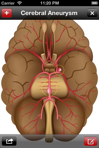 Med Sketch: Anatomy Drawing App screenshot 4