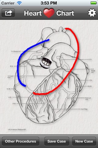 Heart Chart screenshot 2