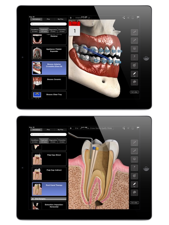 Dental Patient Education screenshot-4