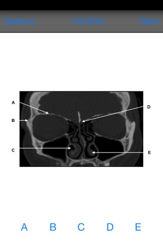 FRCR Radiological Anatomy screenshot 2