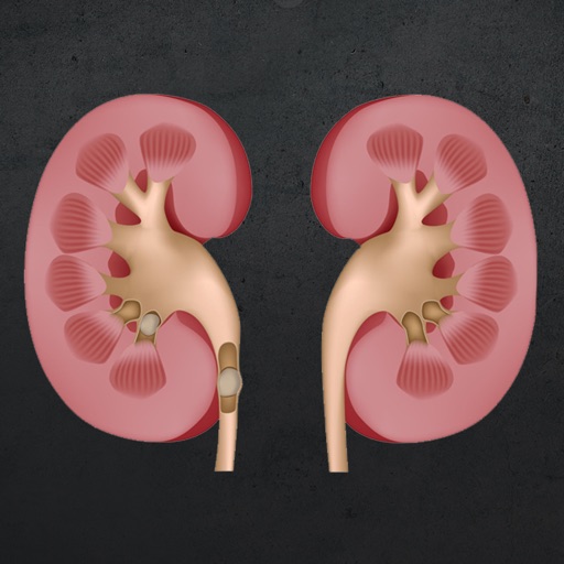 Kidney Stones Icon