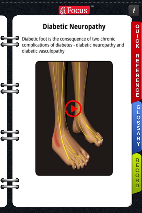 Animated Quick Reference Guide -  DiabeticFoot