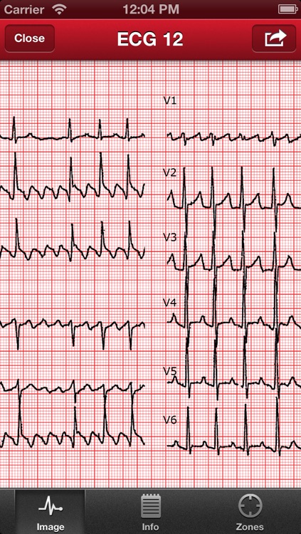 The ECG Collection