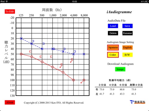 iAudiogramme screenshot 2