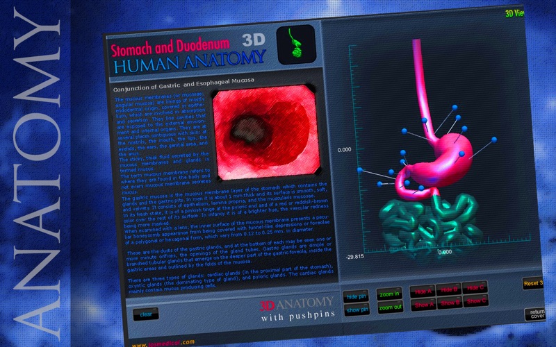 Stomach and Duodeno thumbnail 3